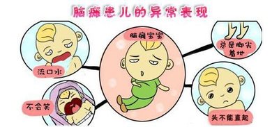 经颅磁治疗仪能治好脑瘫患儿
